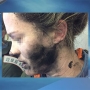 Woman burned after headphones explode on flight to Australia