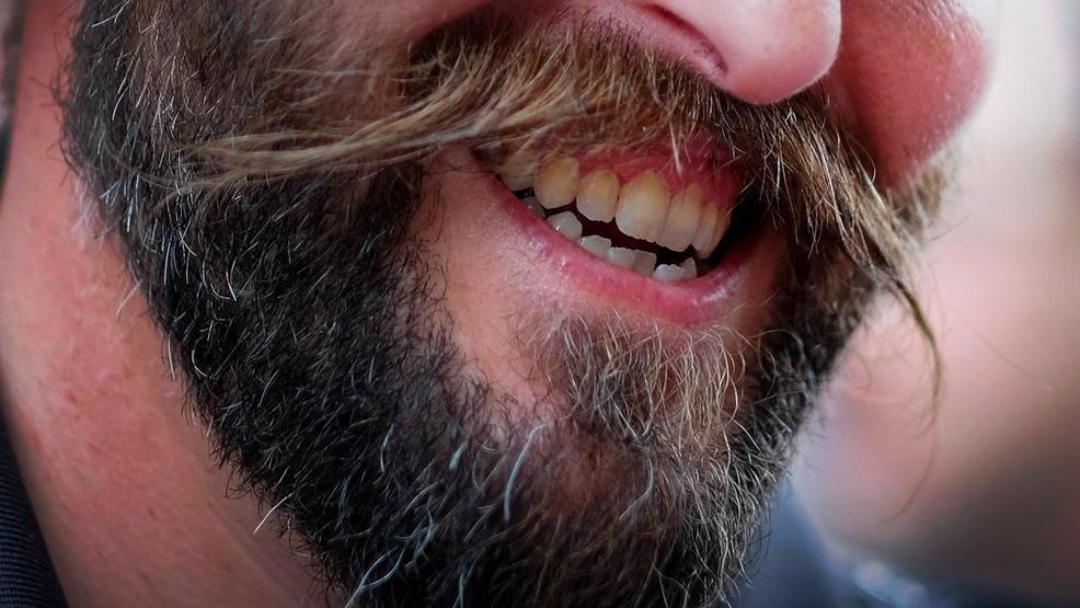 Study: Men with beards carry more germs than dogs do